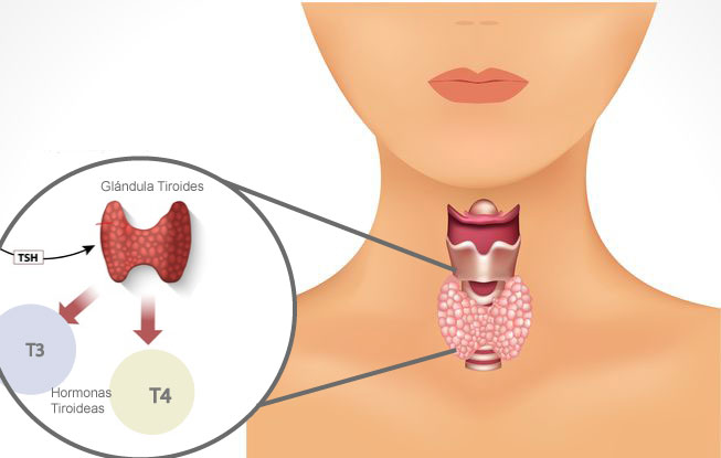 Alimentos yodo tiroides